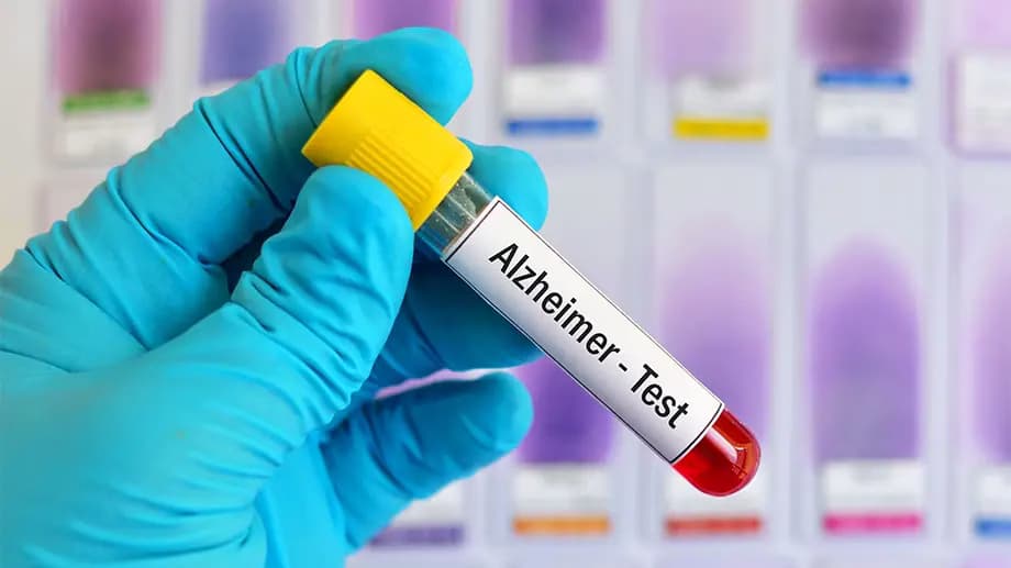 Early Warning: Alzheimer's Blood Marker Identified