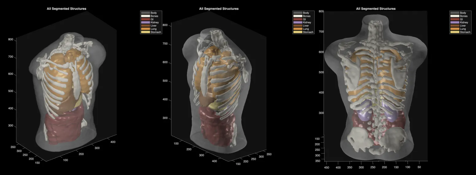 Midjourney Pivots to Healthcare with AI-Powered Full-Body Ultrasound Scans